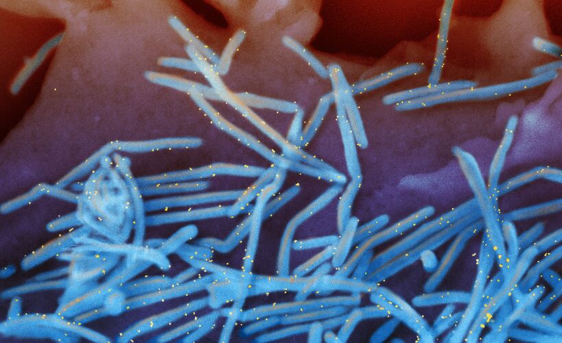 RSV is a common contagious virus that infects the human respiratory tract. 10.25.22 Credit NIAID.png
